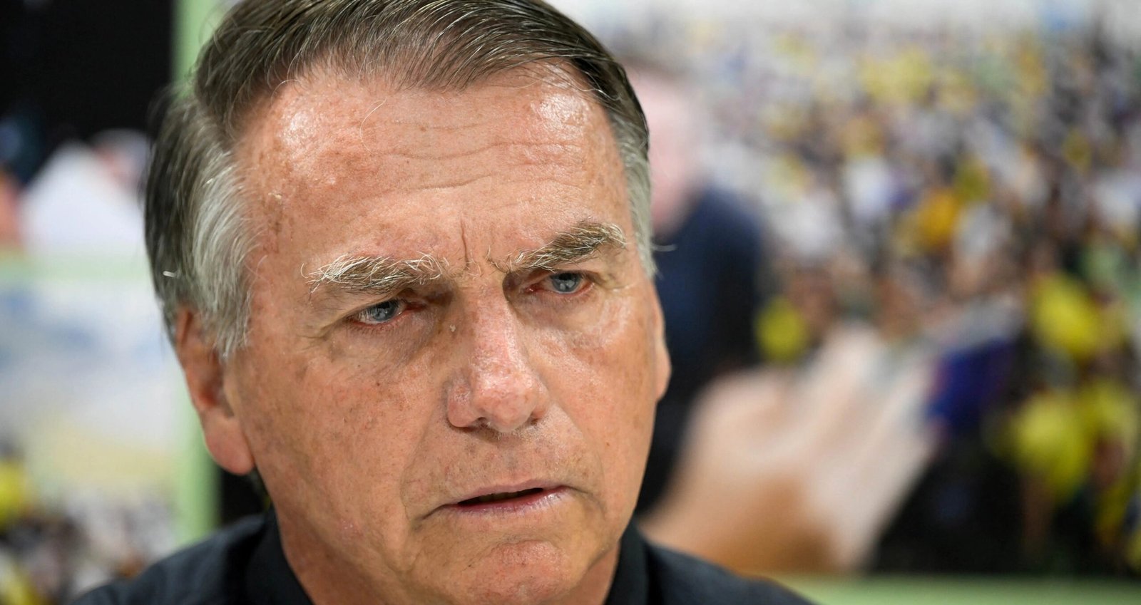 Carlos Bolsonaro diz que Jair Bolsonaro está inchado e irritado na UTI em Brasília - Imagem do artigo